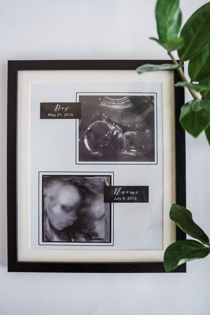 Sonography scans of your kids!